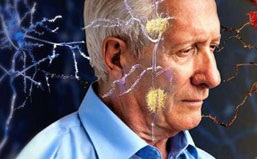 杨永利博士研发的脑波康复耳机能有效防止老人痴呆？